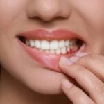 How to Recognize the First Signs of Gum Disease