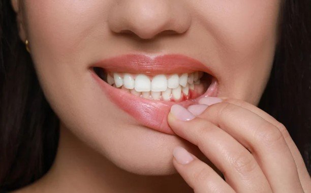 How to Recognize the First Signs of Gum Disease