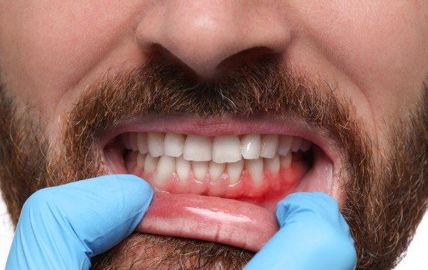 Subtle Shifts in Your Bite